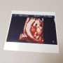 임신10주~14주 증상 - 1차기형아검사