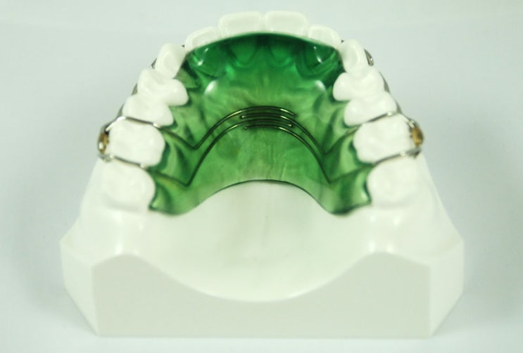 Bite Plate 수직피개 조정 치아교정 장치 네이버 블로그