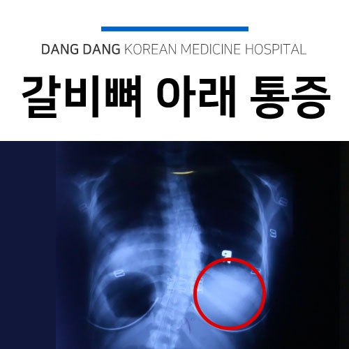 왼쪽 갈비뼈 아래 통증 증상별 원인 네이버 블로그