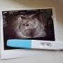 둘째 임테기 두줄, 청라여성병원 첫초음파 아기집확인