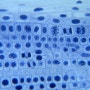 양파뿌리 체세포분열 현미경 관찰 사진 2