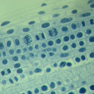 양파뿌리 체세포분열 현미경 관찰 사진 3