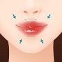 SNS속 그녀들의 입술 ,입꼬리성형술 바로여기 노상훈성형외과