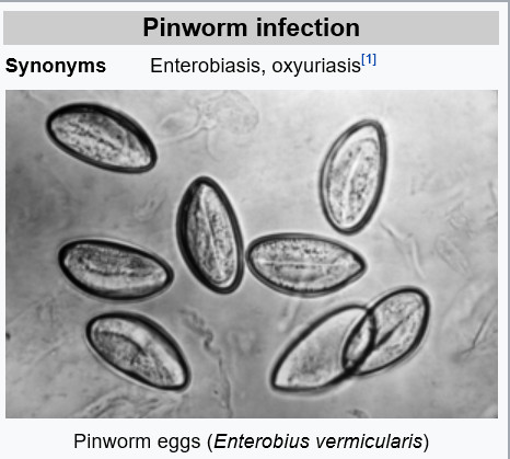 Pinworm Infection 네이버 블로그