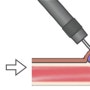 대장 병변의 내시경적 표식법(colonoscopic tattoing)