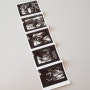 임신 15주 ~ 18주 증상 - 2차 기형아검사 & 성별확인 / 배크기