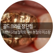 서울대입구 골드크라운 비용 장 단점