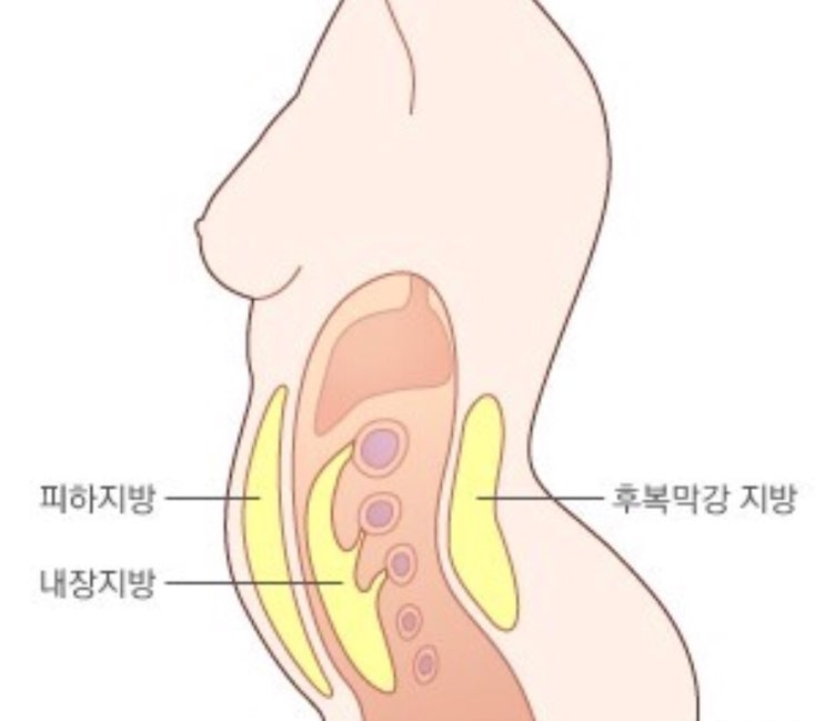 복부비만 내장비만 obesity & overweight : 네이버 블로그