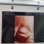 둘째임신 29주 4일째. 8개월 임산부, 몸무게 관리하자, 쑥쑥 크고있는 쑥쑥이