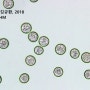 환삼덩굴 꽃가루, 가을철 알레르기의 주범 (현미경 관찰)