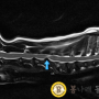 목디스크/ 강아지 침치료 / 수원 한방동물병원