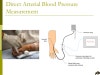 catheter blood pressure measurement