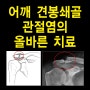 어깨 견봉쇄골 관절염의 올바른 치료 / 청주마디사랑병원