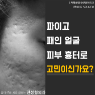 서울 흉터전문병원 이름난 진성형외과!