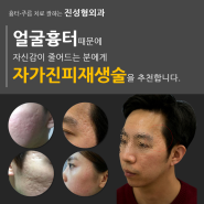 얼굴흉터치료 흉터전문 진성형외과!