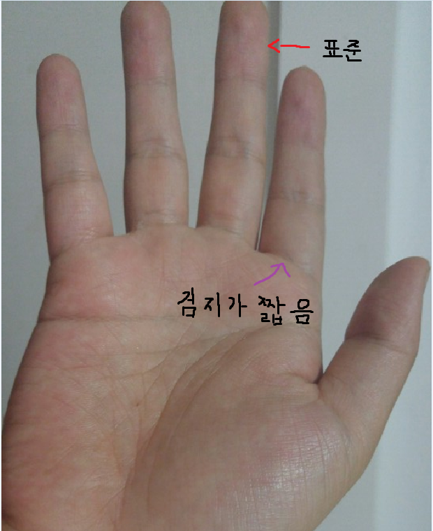 검지 손가락과 약지 손가락이 짧은 경우 : 네이버 블로그