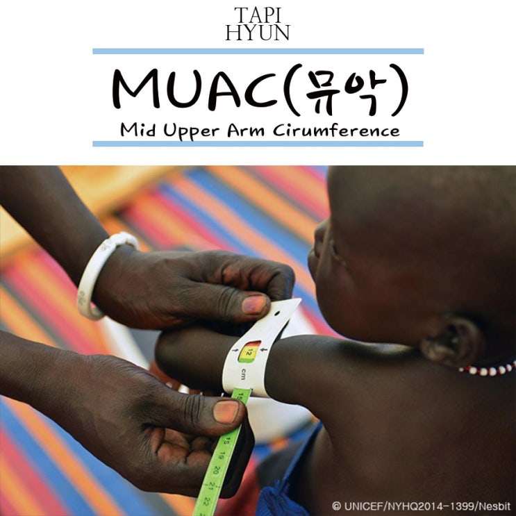 영살실조 검사 (MUAC : 뮤악테이프 / BMI) : 네이버 블로그