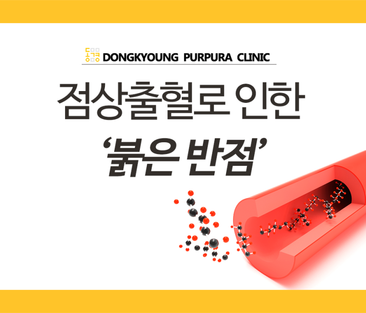 점상출혈로 인한 붉은 반점, 자반증일까? : 네이버 블로그