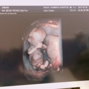 [임신3개월 12주차]사람이된 딴딴이/입체초음파/1차 기형아검사