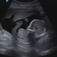 [임신4개월 16주차] 딴딴이의 정체를 알게된날 :)