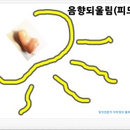 보청기 고장 원인과 해결 방법 2: 음향되울림(피드백)