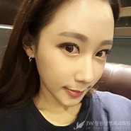 [JW정원성형외과] 턱끝재수술, 비절개눈매교정으로 동안 완성♡ 리얼셀카