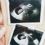 임신8주 3개월
