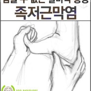 [남양주시, 구리시 수영상의학과] 참을 수 없는 발바닥 통증, 족저근막염에 대해 알아봅시다.