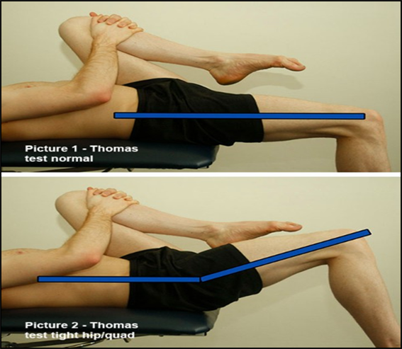 변형된 토마스 테스트 Modified Thomas Test (고관절 굴극근 근길이 검사) : 네이버 블로그