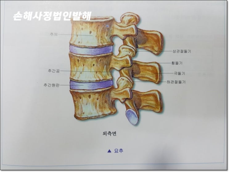 교통사고 흉추.요추 압박골절 후유장애 보상금,보험금손해사정 : 네이버 블로그