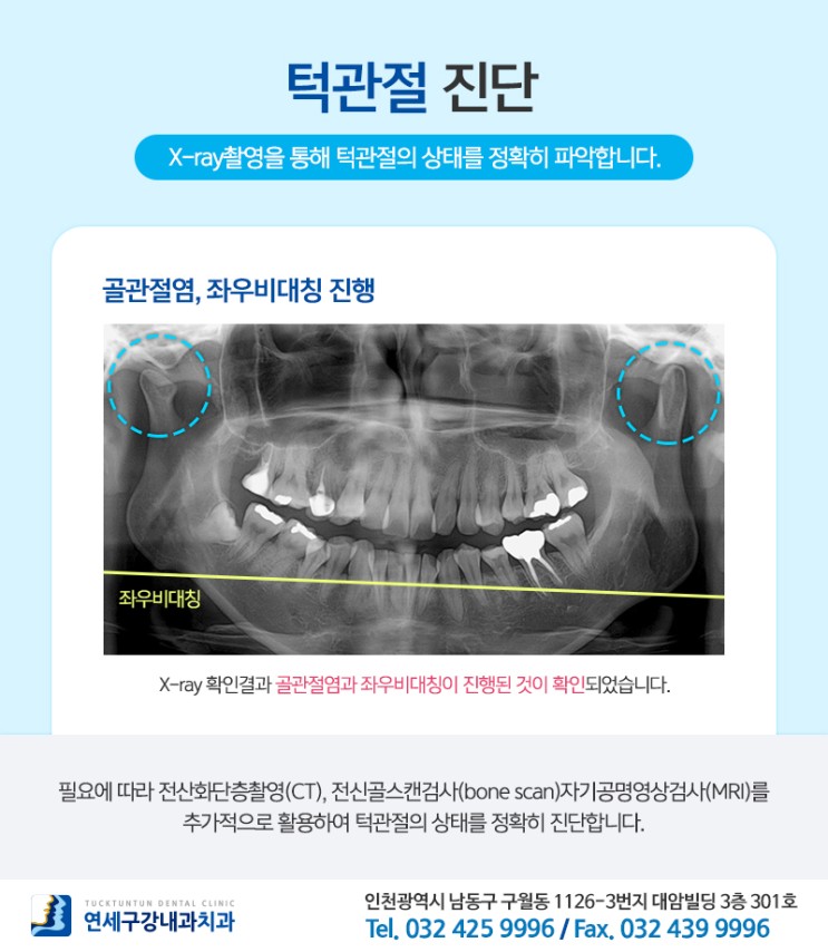 인천 턱관절병원추천 : 정밀한 검진과 증상별 치료 : 네이버 블로그