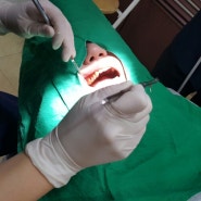 yongsangu english dental.chinese dental.yongsangu dental bleaching
