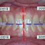 치과 파노라마 엑스레이로 보는 치아이름과 치아번호(치식)
