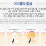 수원여드름 치료잘하는곳 알고싶다