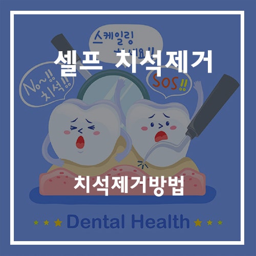 셀프 치석제거와 그 방법을 알아보자! : 네이버 블로그