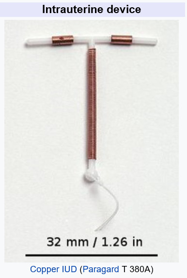 Спираль как выглядит внутри intrauterine device (IUD, IUCD) : 네이버 블로그