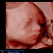 임신 28주 일상 입체초음파로 우리 아기 자세히 봤어요