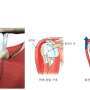 회전근개파열이란? - 이수역 정형외과 연세바른병원
