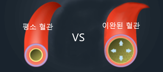 5탄. 패혈증 치료. 패혈증 골든타임 : 네이버 블로그