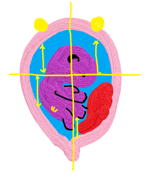 양수(amniotic fluid) 측정법: 양수지수(amniotic fluid index)과 양수주머니, 역할 : 네이버 블로그