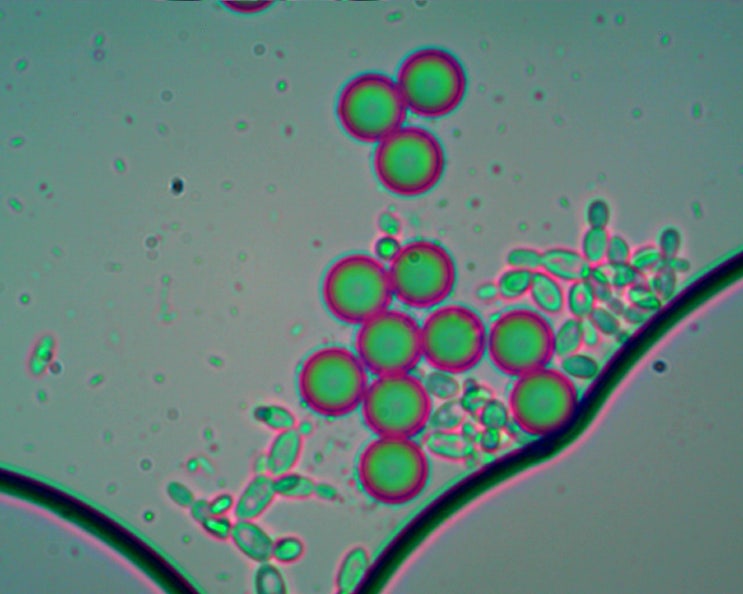 모틱 DM-B1 현미경(MOTIC DM-B1 MICROSCOPE)-10um UK화합물속 효모.유산균 현미경 관찰 사진과 ...