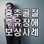 흉추골절 후유장해 보상 사례