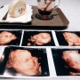쌍둥이 임신 7개월(25주, 26주, 27주, 28주)의 기록