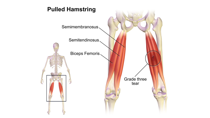 햄스트링 = 햄(ham) + 스트링(string)... 넓적다리살과 힘줄 : 네이버 블로그
