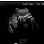 임신 30주 : 정기 검진