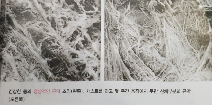 근막의 변화[근막 피트니스] : 네이버 블로그
