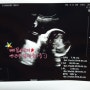 임신 8개월(30주5일)/임신 증상 & 태아크기