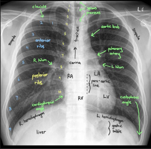 X ray тойота