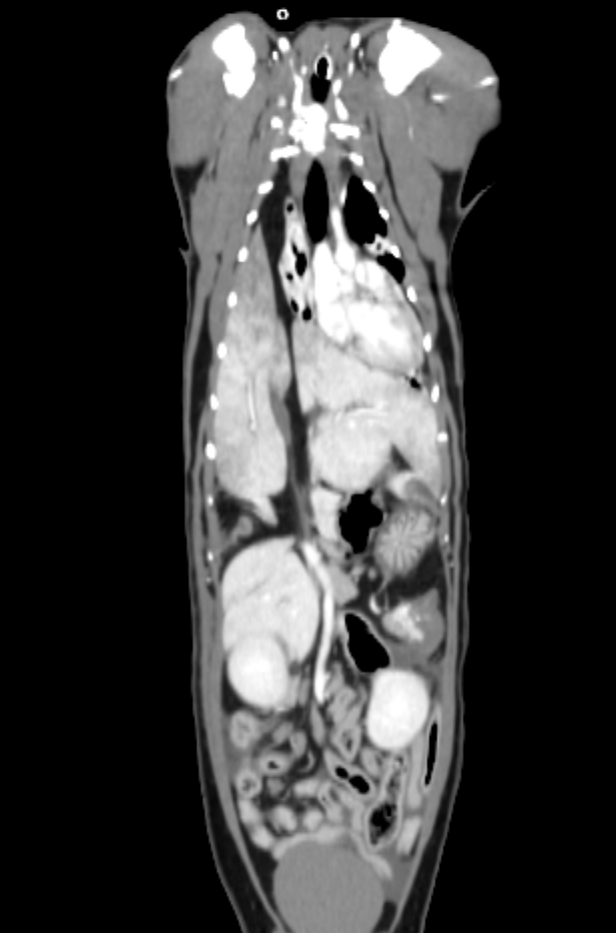고양이 횡경막 파열, 횡경막 탈장, 호흡 곤란 수술 [대전 24시 성심 동물 메디컬 센터, 응급수술, CT 검사] : 네이버 블로그