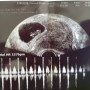 임신 초기 2개월 (임신4주차~임신7주차)증상 및 경험담